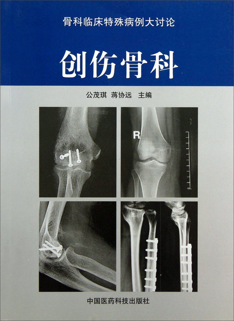 创伤骨科