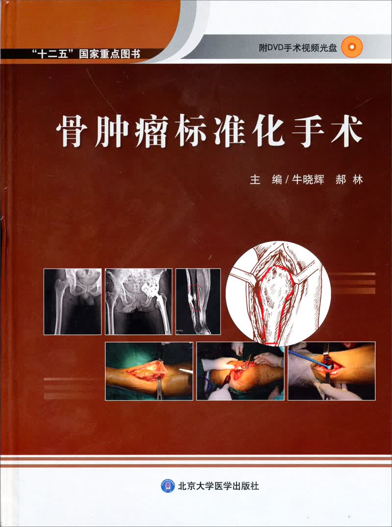 骨肿瘤标准化手术（附DVD光盘）