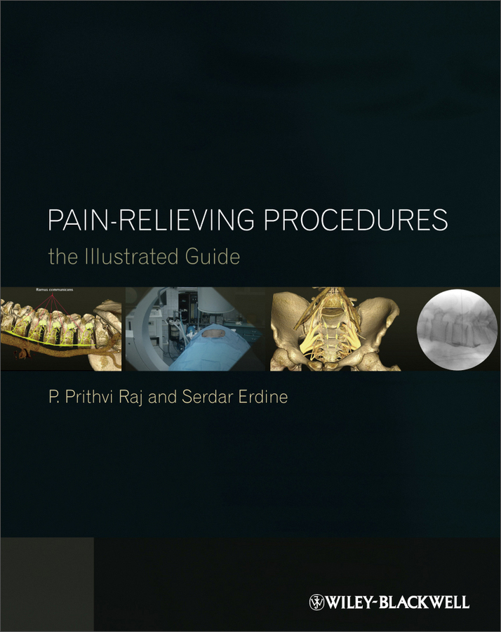 pain-relieving procedures - the illustrated guide