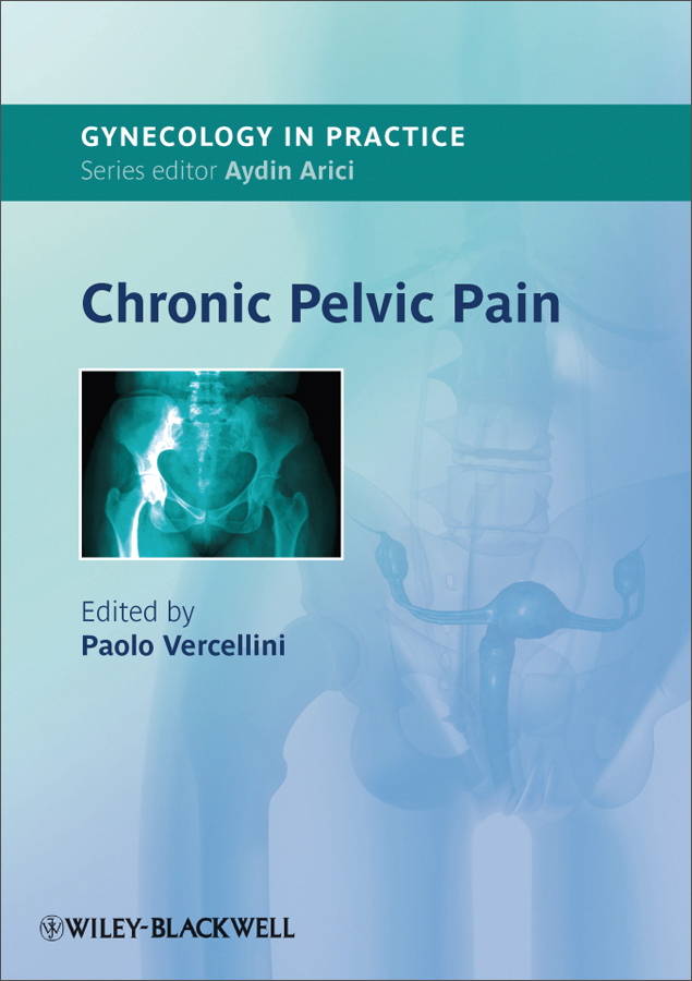 chronic pelvic pain