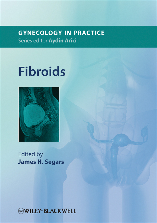 fibroids