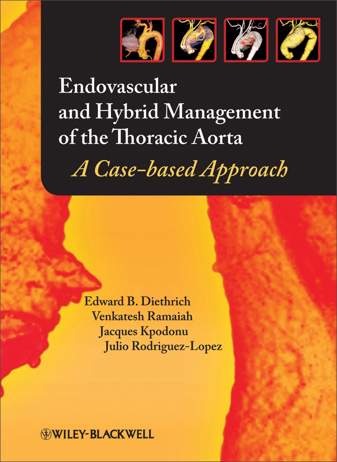 endovascular and hybrid management of the thoracicaorta