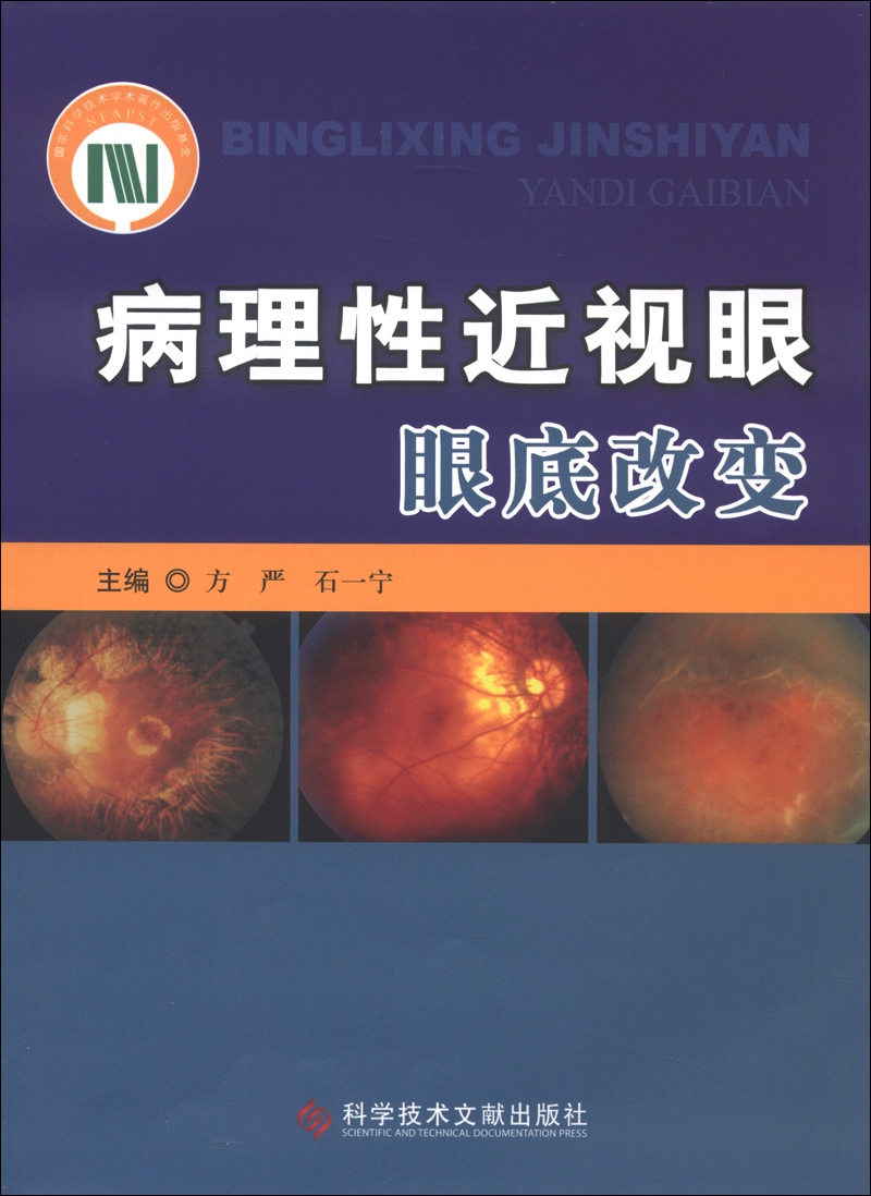 病理性近视眼眼底改变