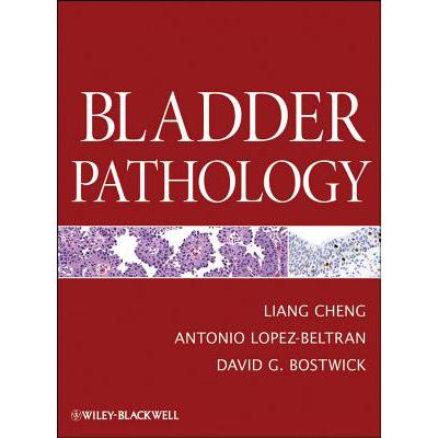 预订 Bladder Pathology [Wiley医学]