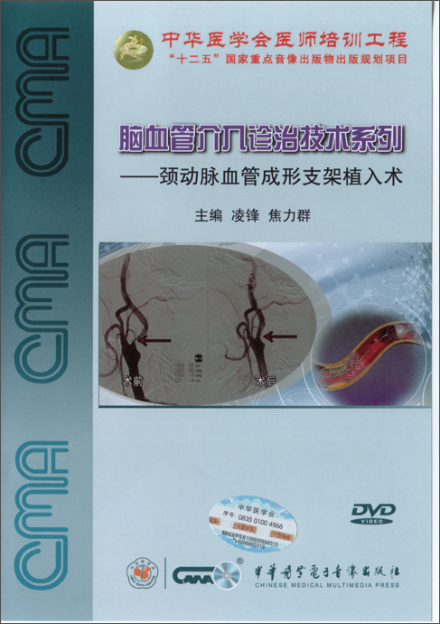脑血管介入诊治技术系列：劲动脉血管成形支架植入术（DVD）