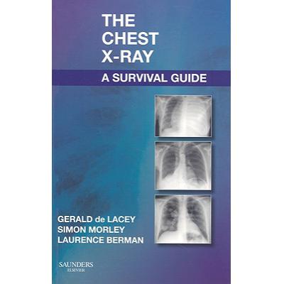 预订 The Chest X-Ray: A Survival Guide