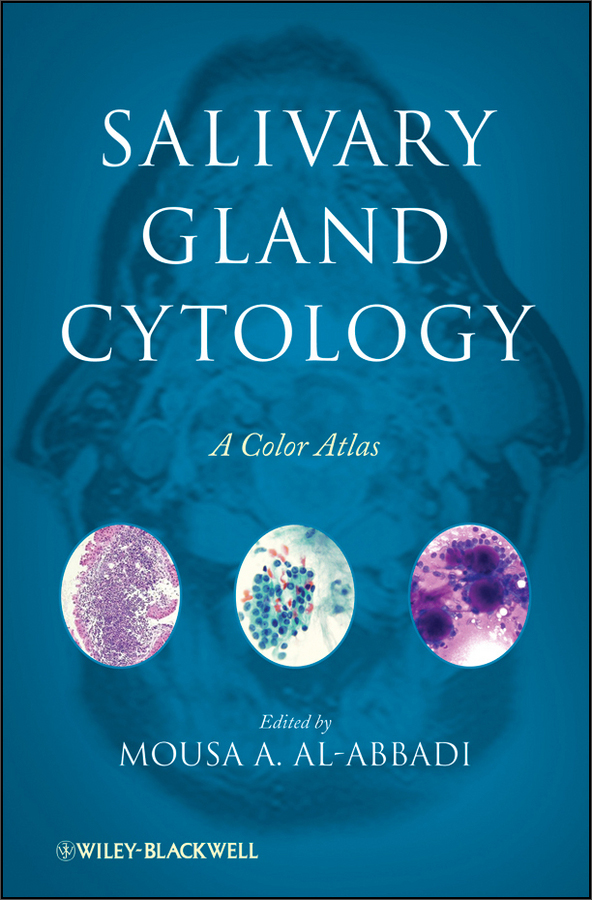 salivary gland cytology: a color atlas