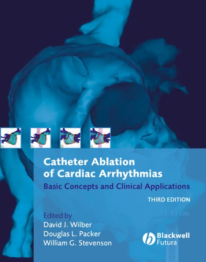 catheter ablation of cardiac arrhythmias - basic concepts and
