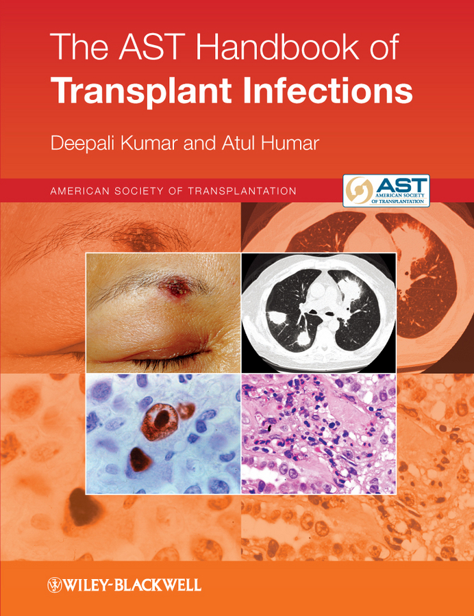 the ast handbook of transplant infections