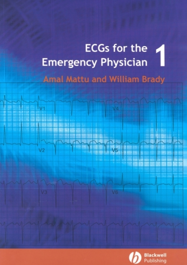 ecgs for the emergency physician 1