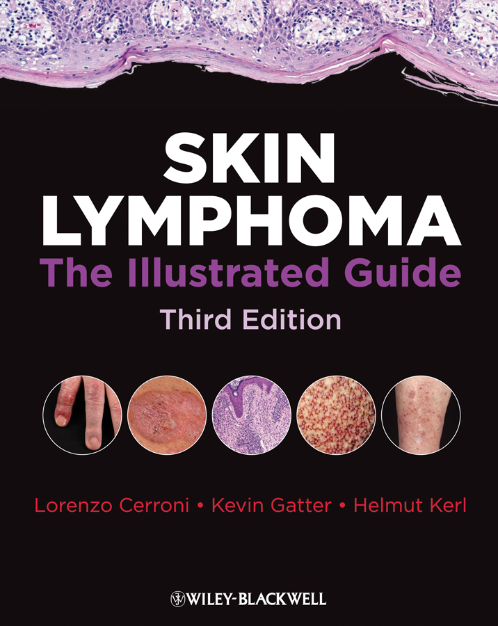 skin lymphoma - the illustrated guide 3e