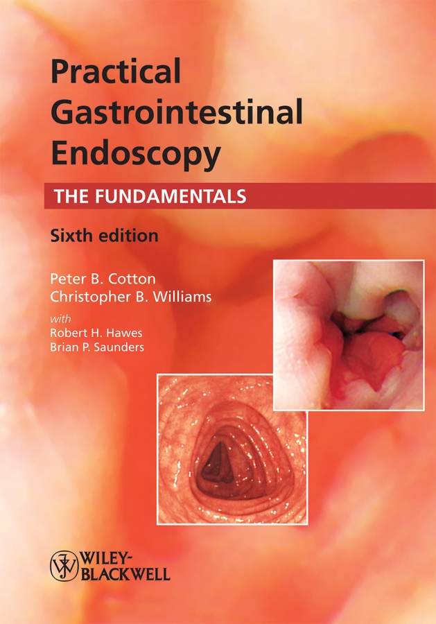 practical gastrointestinal endoscopy - the fundamentals 6e