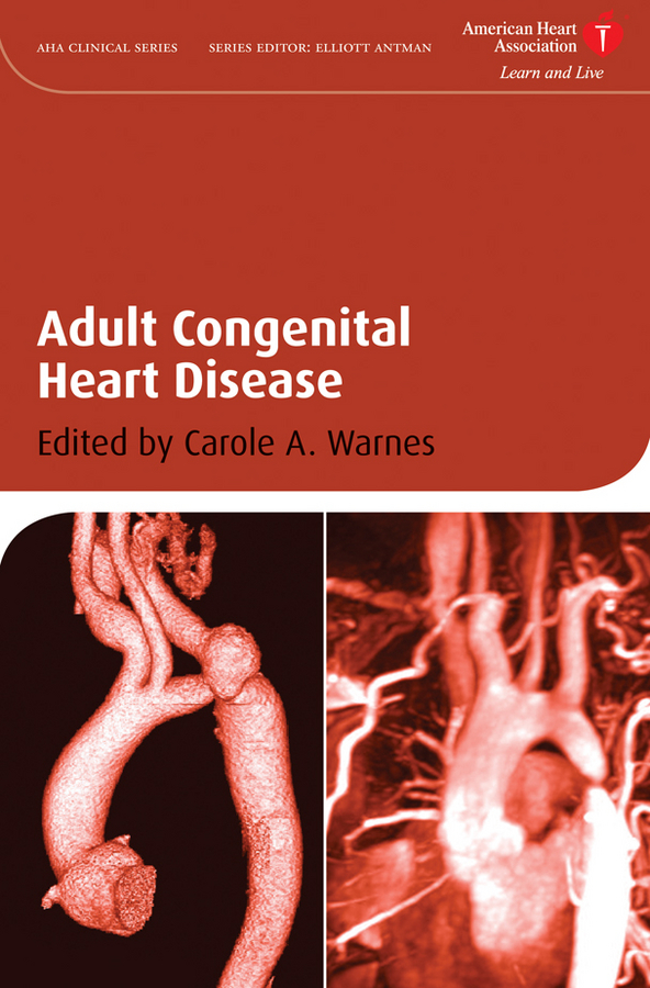 adult congenital heart disease