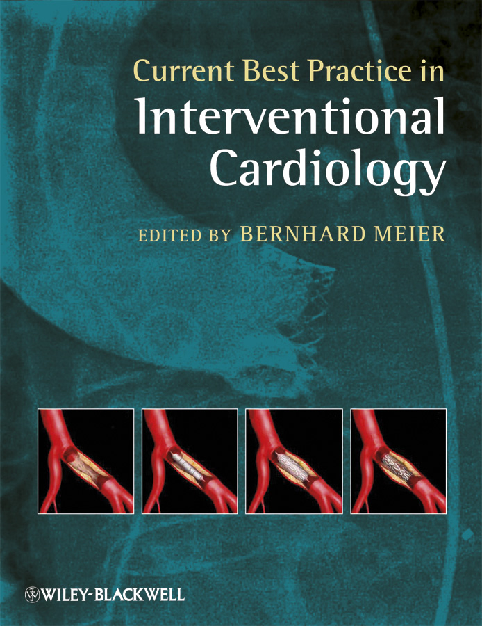 current best practice in interventional cardiology