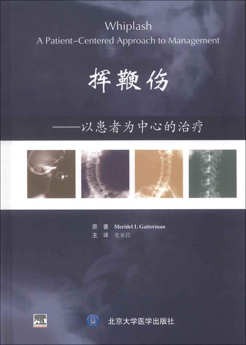 挥鞭伤：以患者为中心的治疗