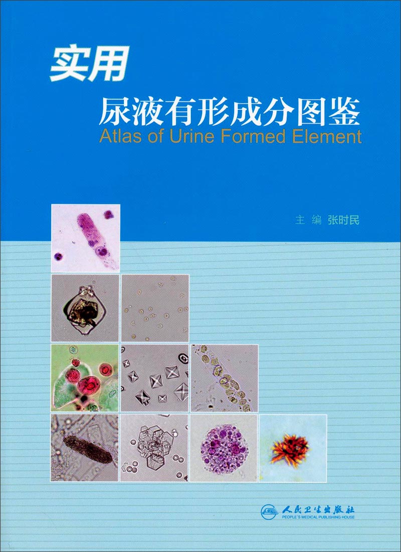 使其作为在做尿液形态学的显微镜检查时,随手可取