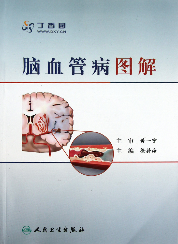 脑血管病图解