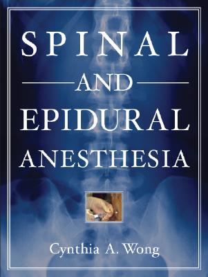 SPINAL AND EPIDURAL ANESTHESIA