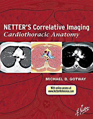 预订 netterx27s correlative imaging: cardiothoracic.