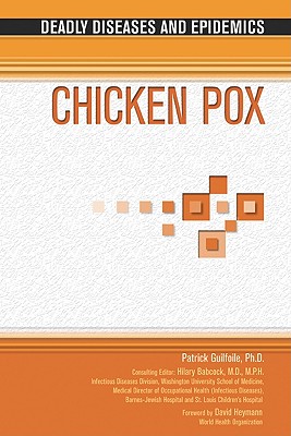 【预订】chicken pox