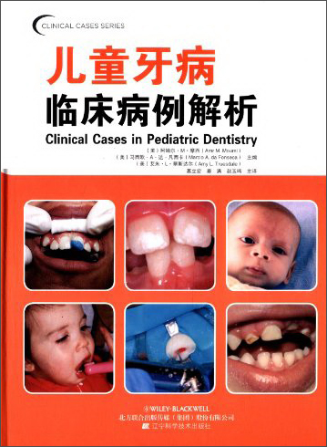 口腔临床病例解析丛书：儿童牙病临床病例解析
