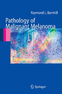 Pathology of Malignant Melanoma