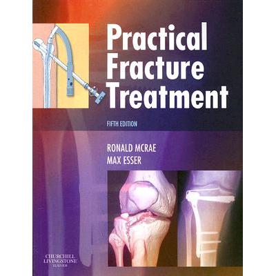预订 Practical Fracture Treatment