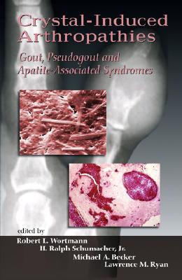【预订】crystal-induced arthropathies: gout,
