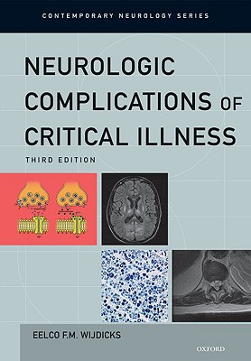 【预订】neurologic complications of critica
