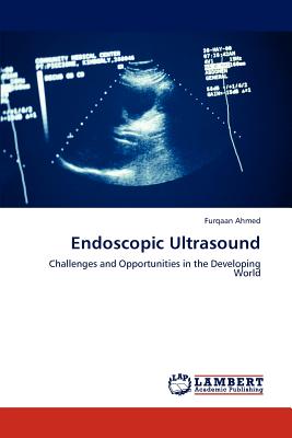 Endoscopic Ultrasound
