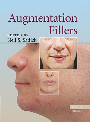 【预订】augmentation fillers