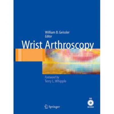 预订 Wrist Arthroscopy