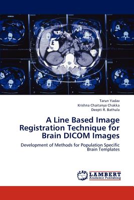A Line Based Image Registratio