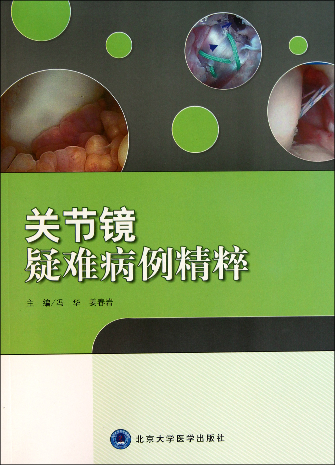 关节镜疑难病例精粹