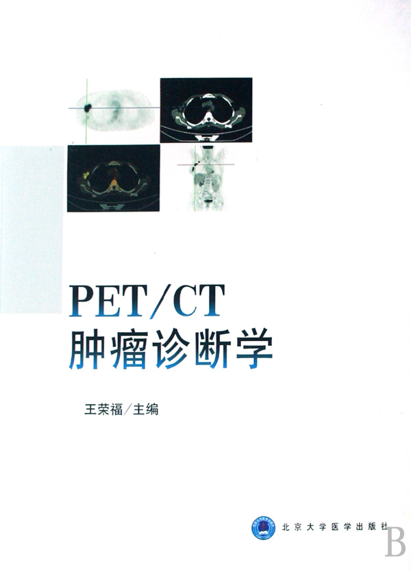 PET\CT肿瘤诊断学