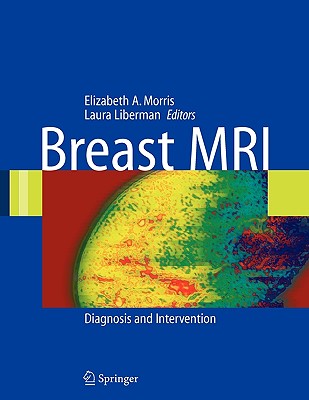 Breast MRI: Diagnosis and