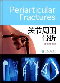 关节周围骨折(精)