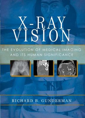 X-Ray Vision: The Evolution of Medical