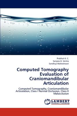 【预订】computed tomography evaluation of