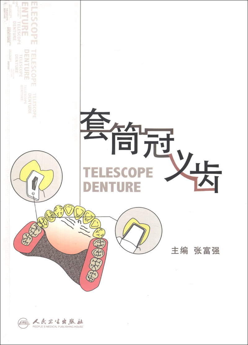 套筒冠义齿