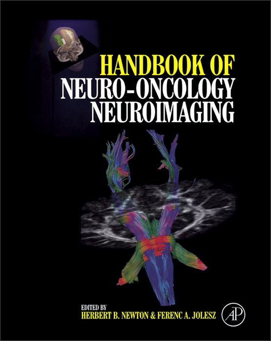 handbook of neuro-oncology neuroimaging