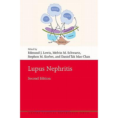 预订 Lupus Nephritis