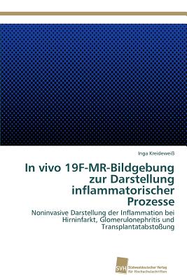 In Vivo 19f-MR-Bildgebung Z