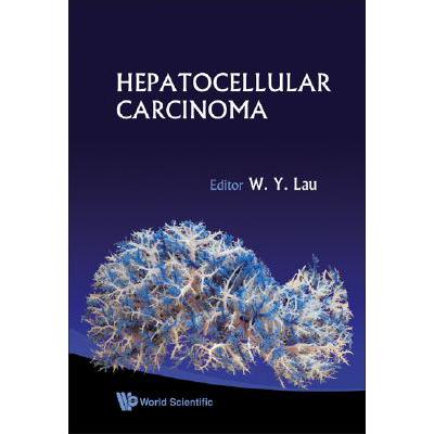 预订 Hepatocellular Carcinoma