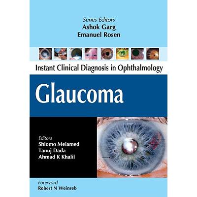 预订 Glaucoma
