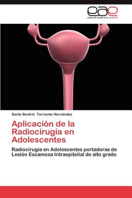 Aplicaci N de La Radiocirug a En