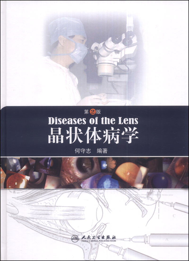 [正版图书]晶状体病学（第2版）