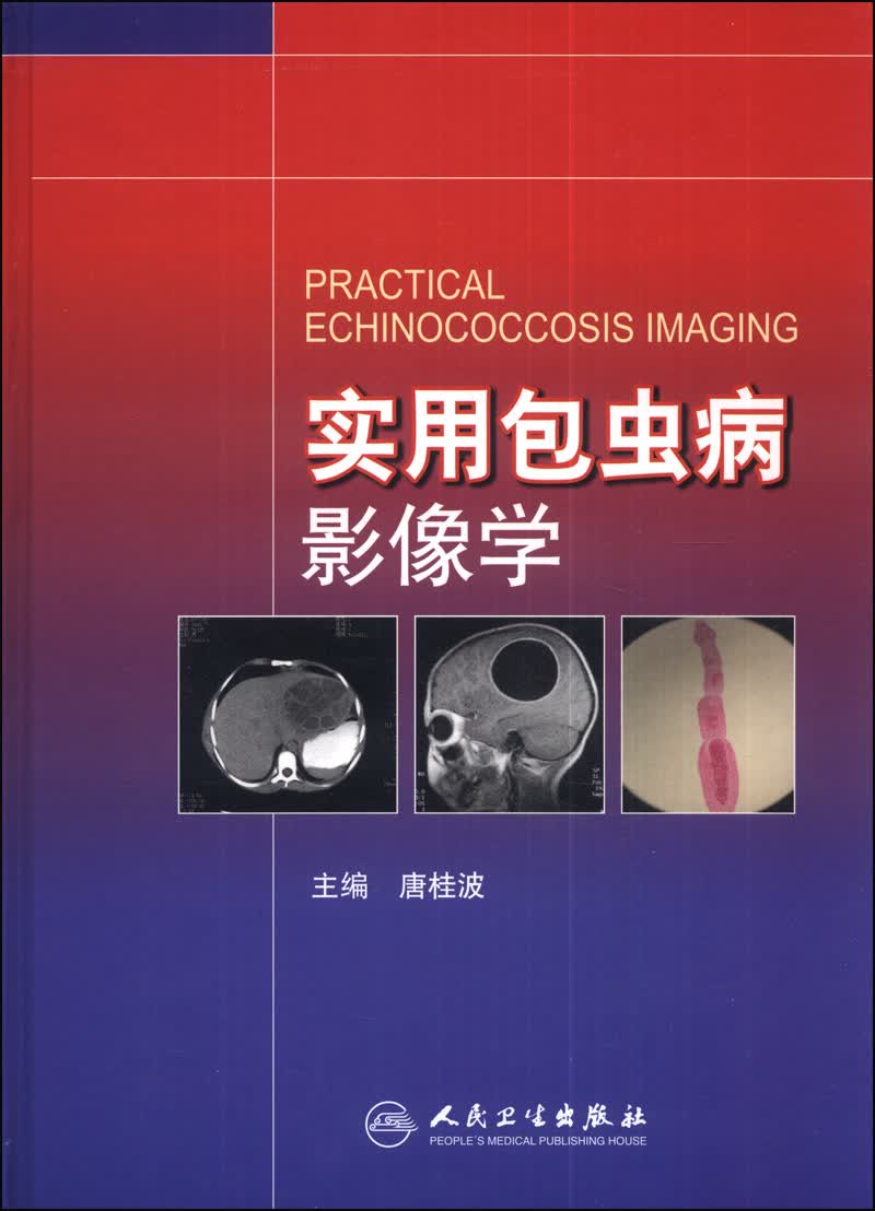 实用包虫病影像学