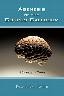 预订 agenesis of the corpus callosum: the beast within 胼胝体