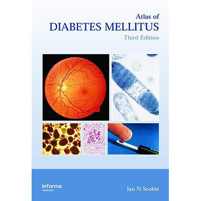 预订 Atlas of Diabetes Mellitus